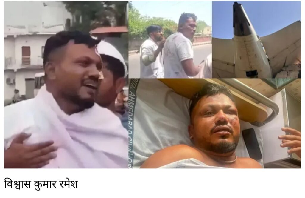 प्लेन क्रैश में जीवित बचे विश्वास हुए डिस्चार्ज, ठुकरा दी एअर इंडिया की ये पेशकश